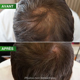 Shampoing Énergisant Densité Pro BBHAIR Generik 250 ML
